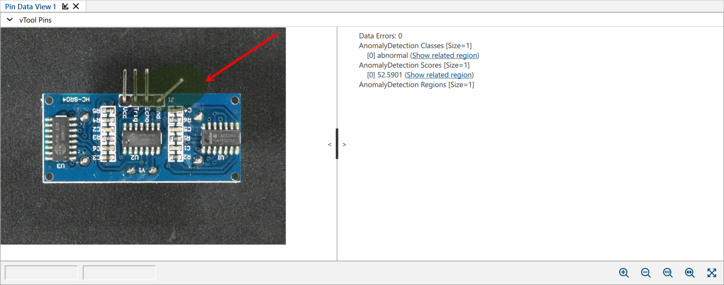 Anomaly Detection with Regions Pin Selected